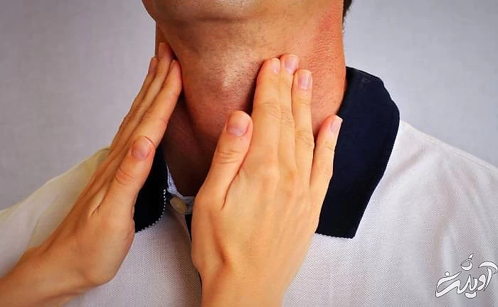عملکر تیروئید